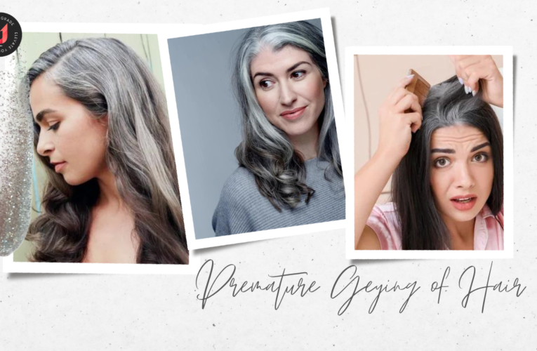 What causes Premature greying of Hair?